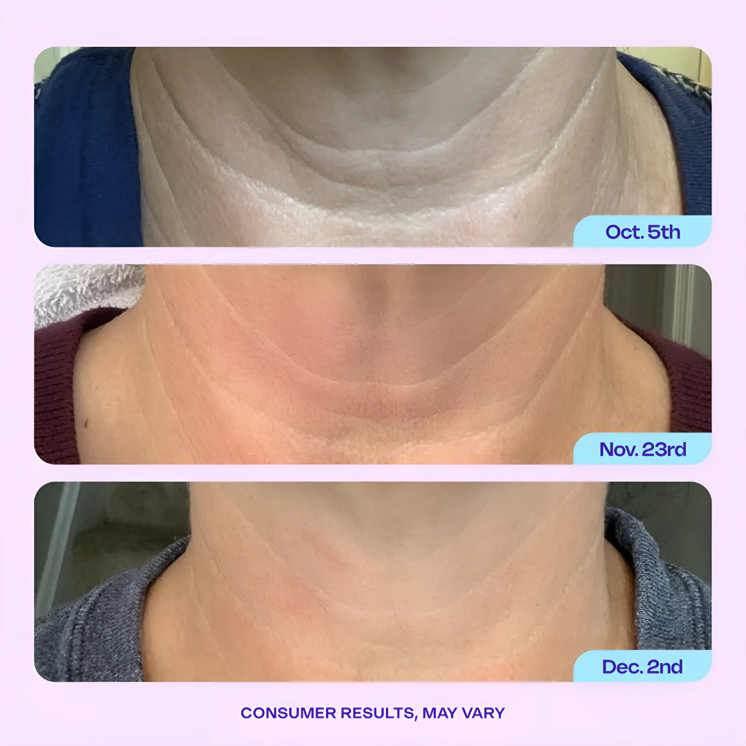 DermaLift™ - Neck Firming Cream